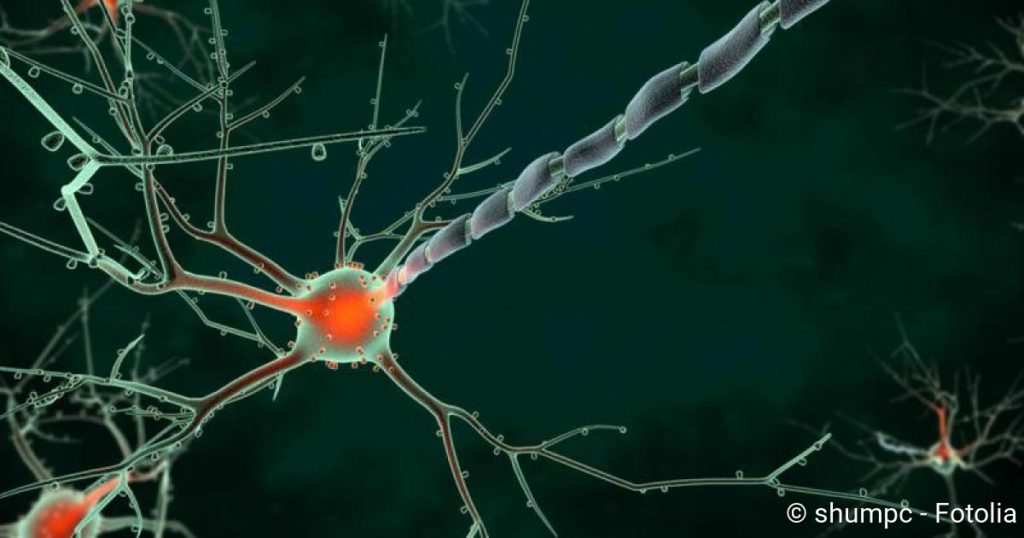 Polyneuropathy: symptoms, causes, therapy – Medical Society